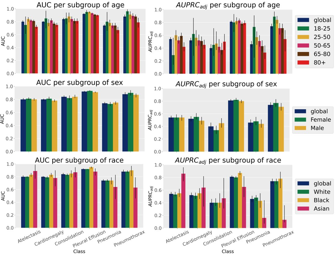 barplot of performances for the MedCLIP model.