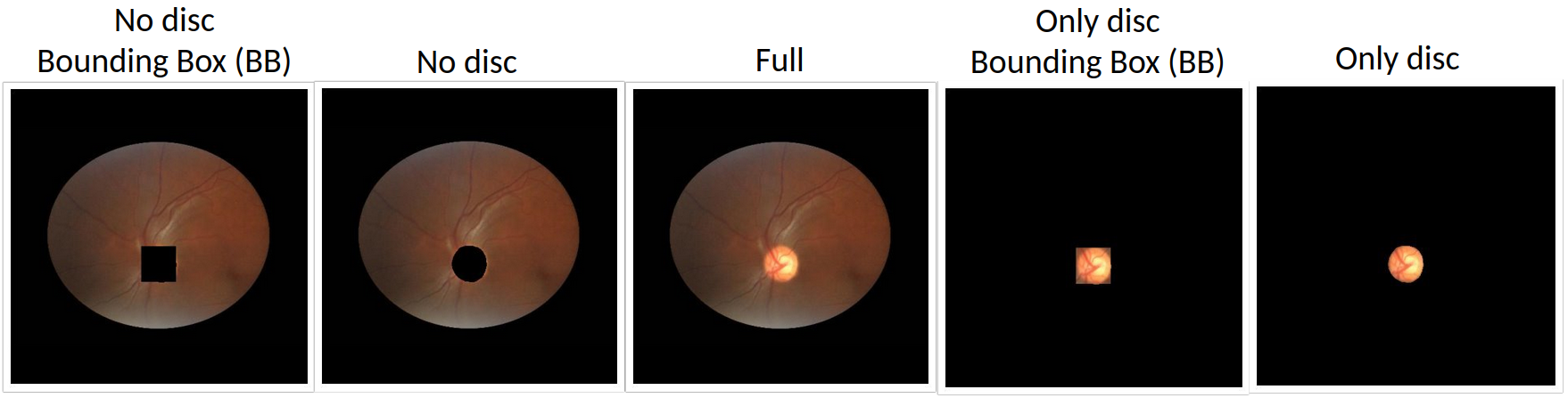 The different types of images depending on the masked area.