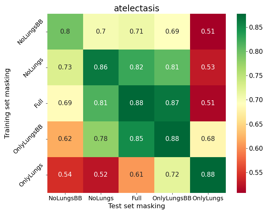 AUCs for the atelectasis class.