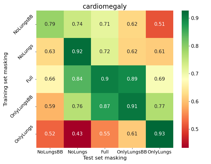 AUCs for the cardiomegaly class