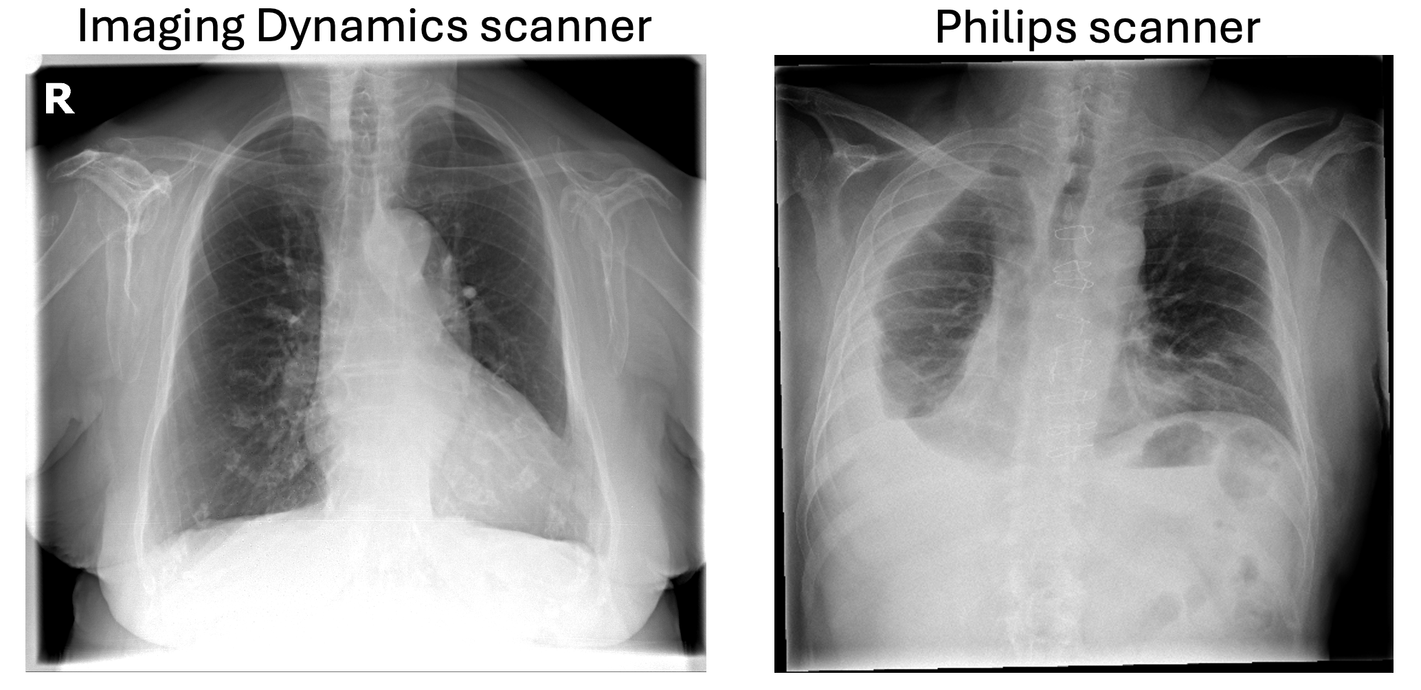 Example of data from PadChest